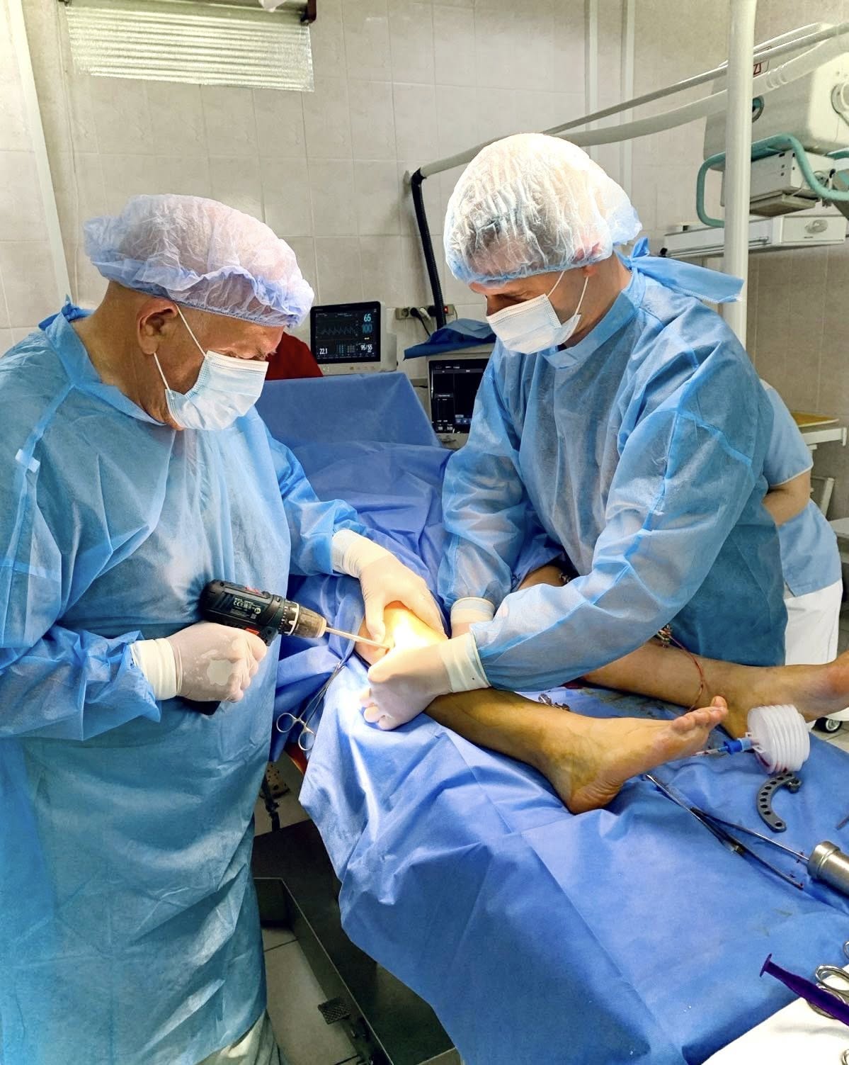 На Вінниччині медики провели операцію-корекцію на гомілках пацієнта - фото 3