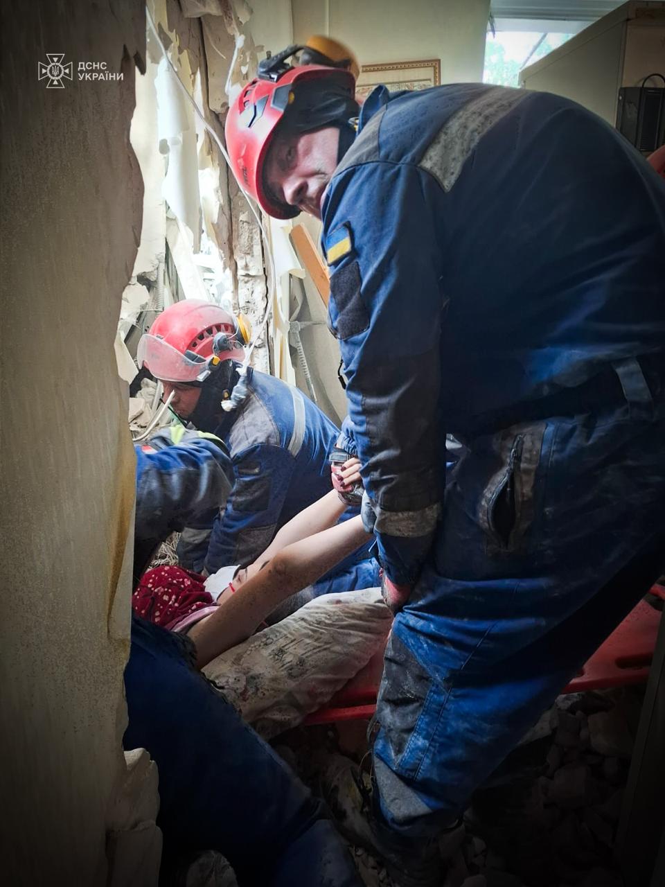 «Головне — жива»: історія порятунку киянки Валерії, яка опинилася під завалами власної квартири - фото 4