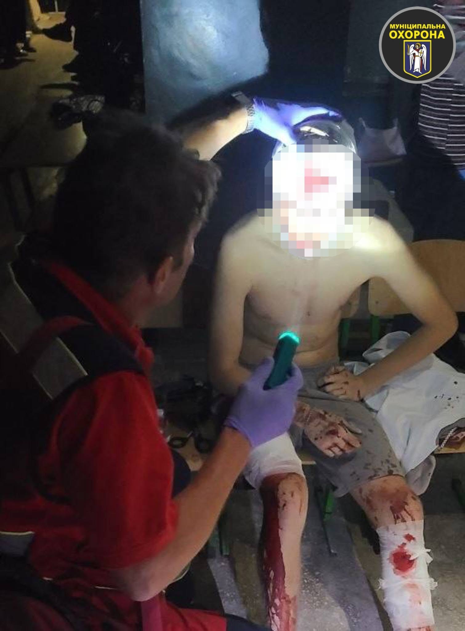 Пораненого під час атаки 18-річного хлопця рятували в укритті київського закладу освіти - фото 2