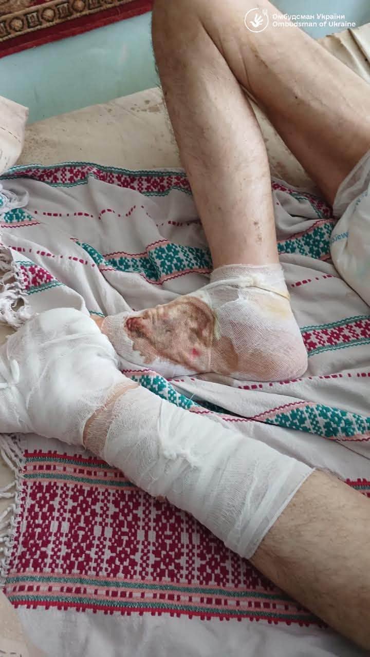 Пролежні і одна мочалка на всіх – порушення виявили у «Центрі надання соціальних послуг» на Черкащині - фото 5